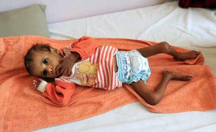 ONZ alarmuje: Grozi nam największa od 100 lat klęska głodu