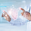 Akcje Medicalgorithmics bardzo mocno w górę