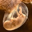 Żaden zmodyfikowany zarodek nie zostanie wszczepiony kobiiecie — obiecują naukowcy
