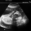 Szwecja: Chcą prawa do aborcji dla mężczyzn