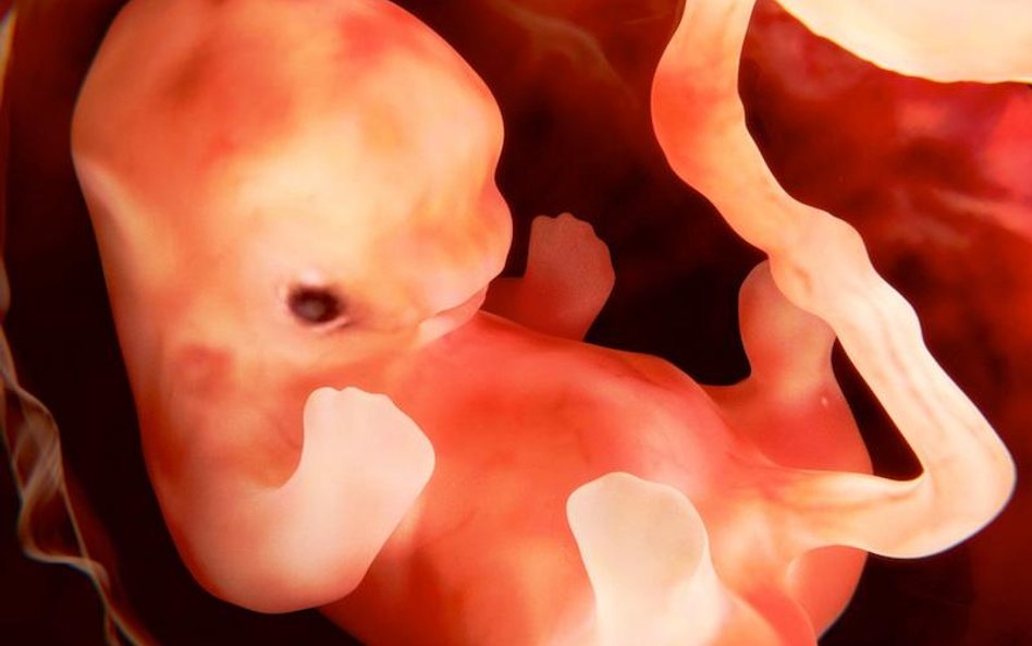 15 dzieci — jeszcze w łonie matki — otrzyma zastrzyki komórek macierzystych
