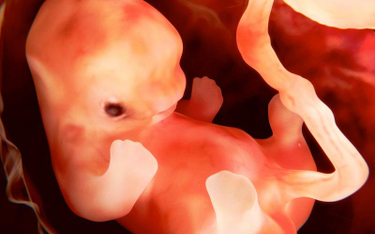 15 dzieci — jeszcze w łonie matki — otrzyma zastrzyki komórek macierzystych