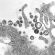 Obraz mikroskopowy wirusa Lassa