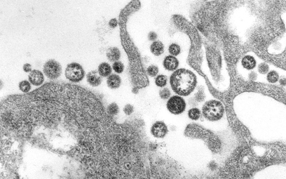 Obraz mikroskopowy wirusa Lassa