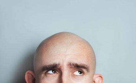 Łysi przyszłością świata