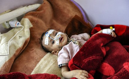 Jemen: Ponad 7,5 tys. dzieci zabitych lub okaleczonych