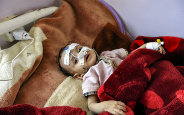 Jemen: Ponad 7,5 tys. dzieci zabitych lub okaleczonych