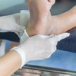 Owrzodzenia cukrzycowe dotykają ok. 15 procent osób z cukrzycą. Są to bolesne rany, które mogą ostat