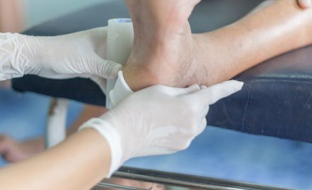 Owrzodzenia cukrzycowe dotykają ok. 15 procent osób z cukrzycą. Są to bolesne rany, które mogą ostat