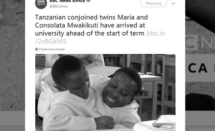 Tanzania: Słynne bliźniaczki syjamskie nie żyją