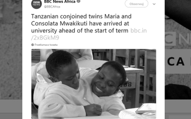 Tanzania: Słynne bliźniaczki syjamskie nie żyją