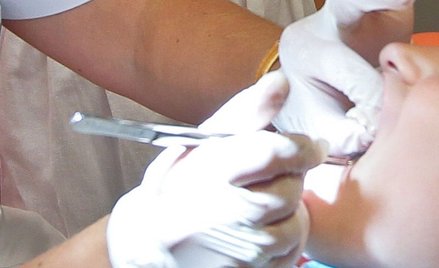Wielka Brytania: 18 miesięcy w kolejce do dentysty