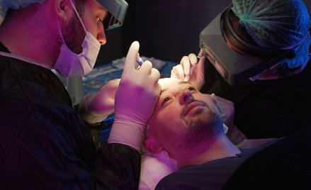 Przeszczep włosów w Turcji – 10 najważniejszych pytań