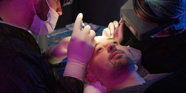 Przeszczep włosów w Turcji – 10 najważniejszych pytań