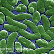Bakteria Vibrio vulnificus