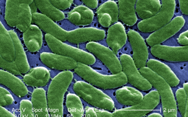 Bakteria Vibrio vulnificus