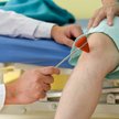 Neuropatia: Kiedy cukrzyca zaczyna boleć