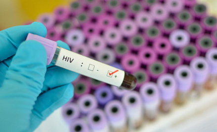 Uczestnik wypadku nosicielem HIV. Apel policji