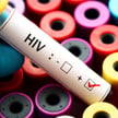 Po diagnozie HIV. Czy trzeba informować pracodawcę? Co z kontaktem z bliskimi?