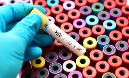 Wirus HIV nie odpuszcza. W 78 proc. przypadków nie znamy drogi zakażenia