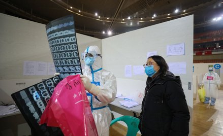 Koronawirus może wywołać nieodwracalne zmiany w płucach