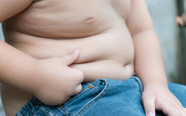 RPD apeluje w sprawie nadwagi i otyłości wśród dzieci