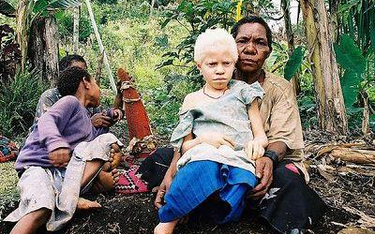 Albinosi rodzą się także wśród mieszkańców Nowej Gwinei