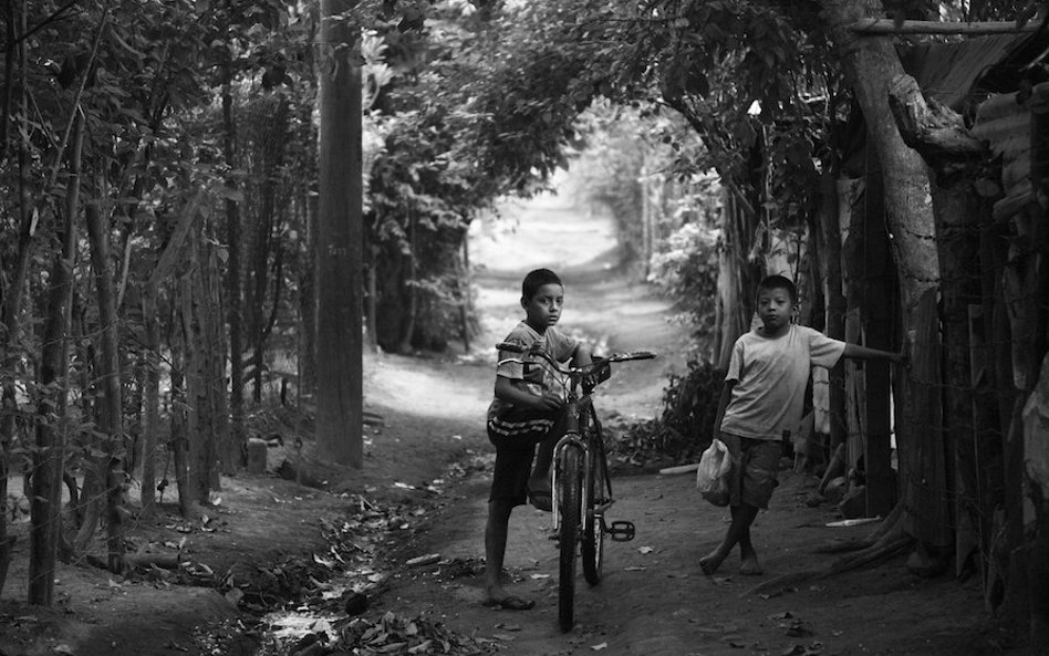 Fot: Joshua Mcdonald. W Chichigalpa, mieście w Nikaragui w Ameryce Środkowej, przewlekła choroba ner