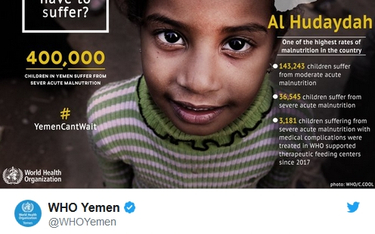 UNICEF alarmuje: W Jemenie co 10 minut umiera dziecko