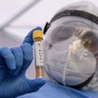 NCBR przekaże 200 mln zł na walkę z koronawirusem. Spółki już się szykują