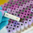 Ukraina: Konflikt zbrojny doprowadził do epidemii HIV