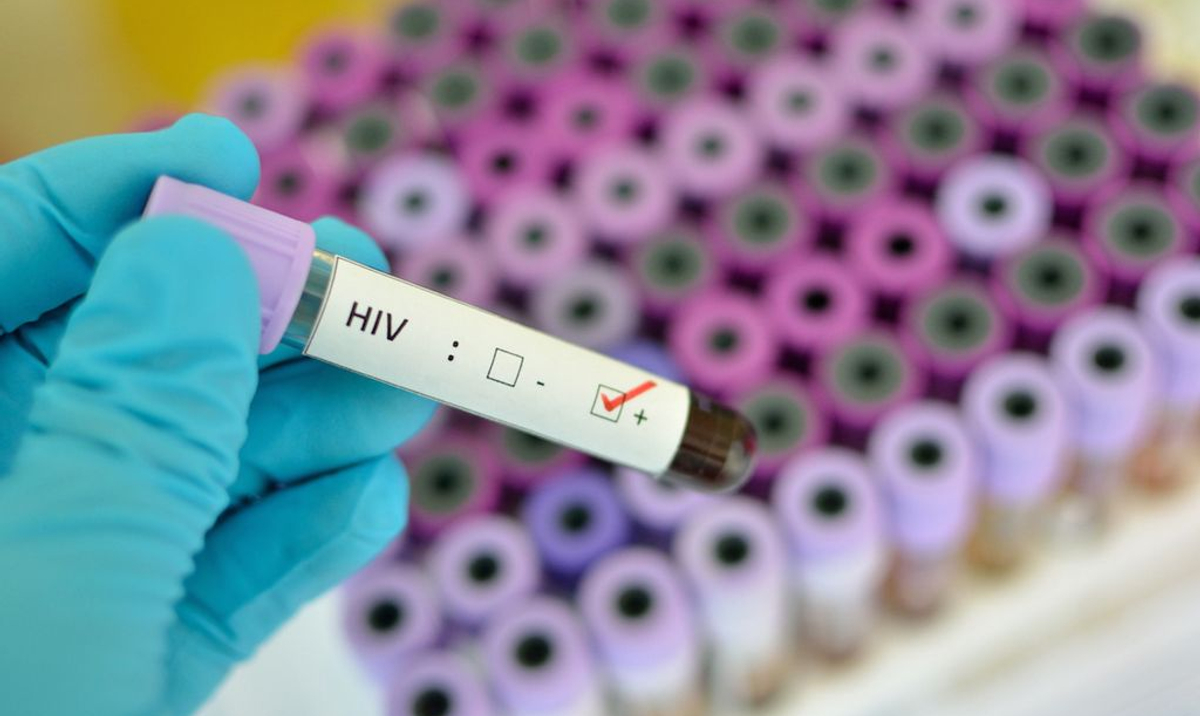 Ukraina: Konflikt zbrojny doprowadził do epidemii HIV