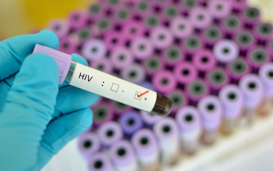 Ukraina: Konflikt zbrojny doprowadził do epidemii HIV