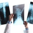 Radiolodzy mogą prześwietlać chorych dłużej