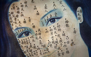 Akupunktura - wieki chińskiej mądrości