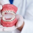 Dentysta bez specjalizacji może nałożyć aparat na zęby