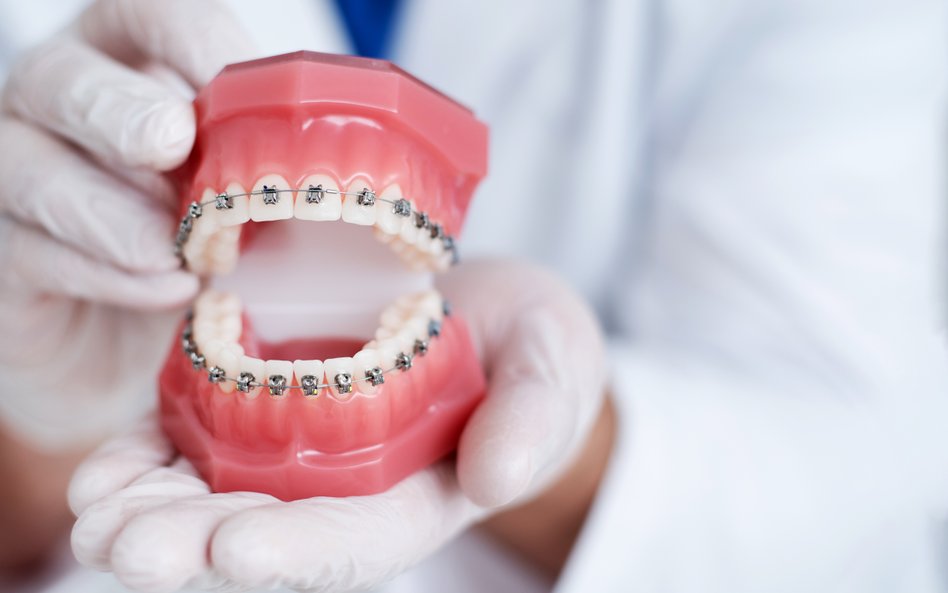 Dentysta bez specjalizacji może nałożyć aparat na zęby