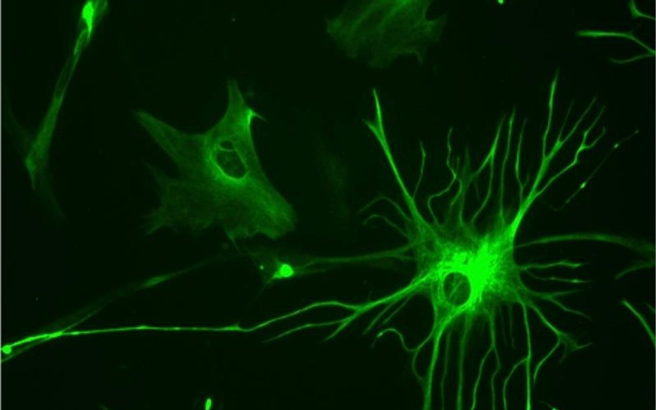 Astrocyty, największe z komórek glejowych.