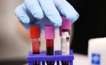 Wzrost zachorowań wspiera kurs Mercatora