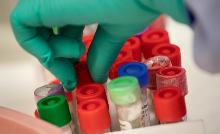 Prof. Krzysztof Pyrć: Musimy być przygotowani na kolejne uderzenie wirusa