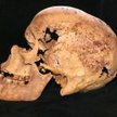 Czaszka kobiety żyjącej 4200 lat temu i chorującej na raka piersi