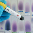 Światowy Dzień Walki z AIDS