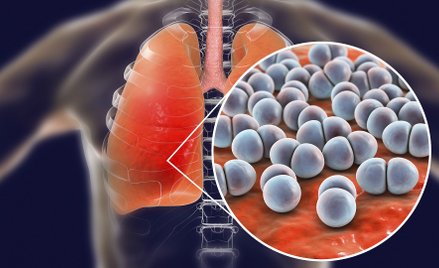 Szczepienia dla dorosłych powinny być bezpłatne, zwłaszcza u osób z grup ryzyka, np. cukrzyków