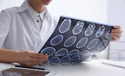 Według wielu neurologów prowadzenie programu lekowego dla chorych na SM nie opłaca się szczególnie n