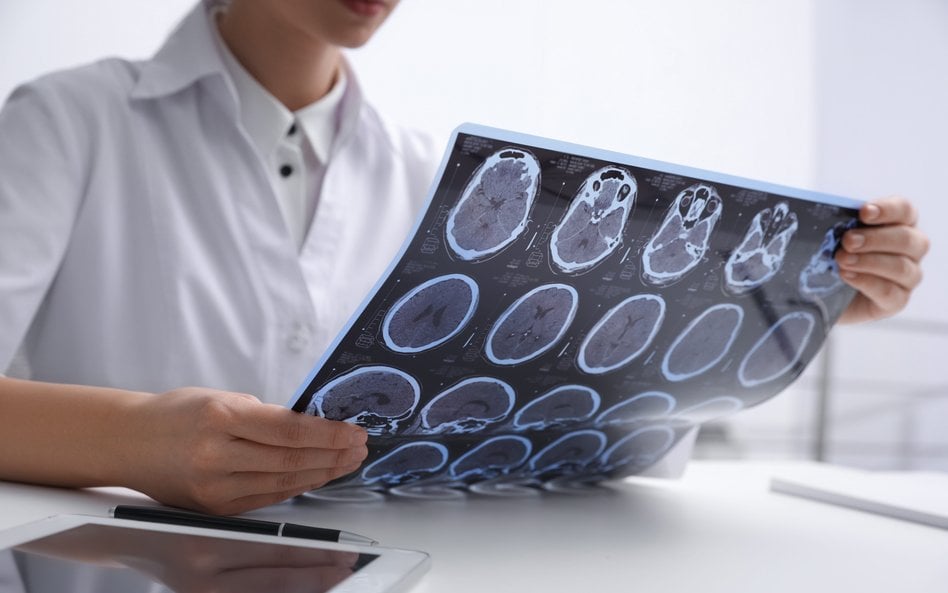 Według wielu neurologów prowadzenie programu lekowego dla chorych na SM nie opłaca się szczególnie n