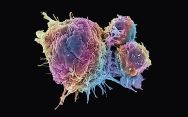 Limfocyty T atakują komórkę nowotworu – zdjęcie ze skaningowego mikroskopu elektronowego