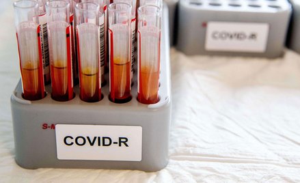 CDC: Nie używać testów na przeciwciała do sprawdzenia odporności na koronawirusa