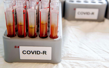 CDC: Nie używać testów na przeciwciała do sprawdzenia odporności na koronawirusa