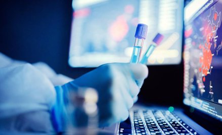 Jak zarobić na wykryciu wirusa?