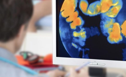 Nowotwór jelita grubego może stać się chorobą przewlekłą.